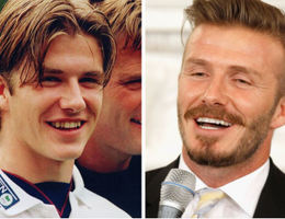 David Beckham zuby