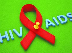 HIV AIDS