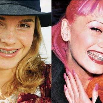 zena, rovnatka