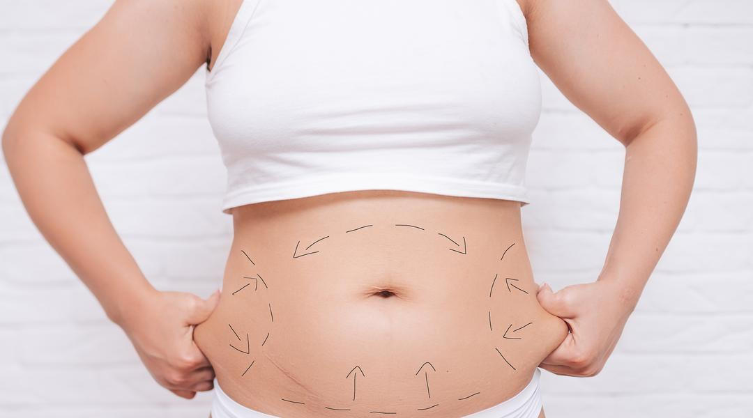 Plánování plastické operace / liposukce