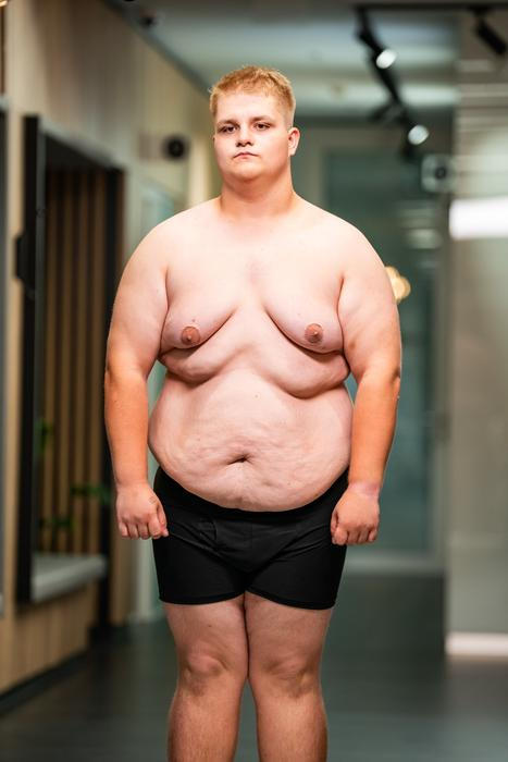 Extrémní proměny: Jarda