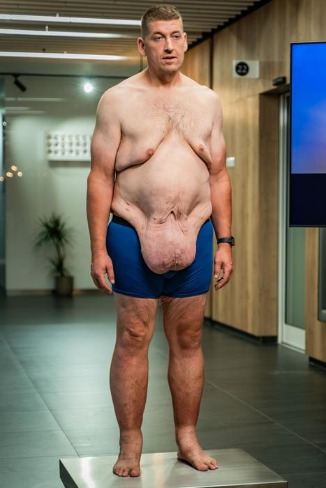 Extrémní proměny: Lukáš