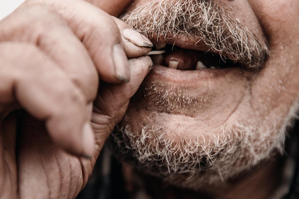 Zkažené a chybějící zuby