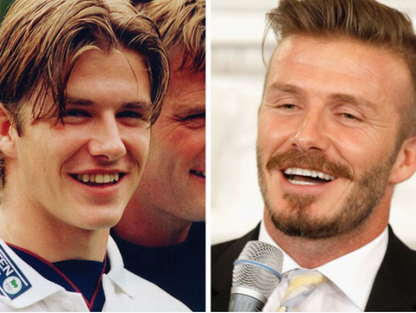 David Beckham zuby