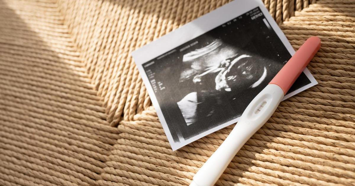 Těhotenský test a ultrazvuk