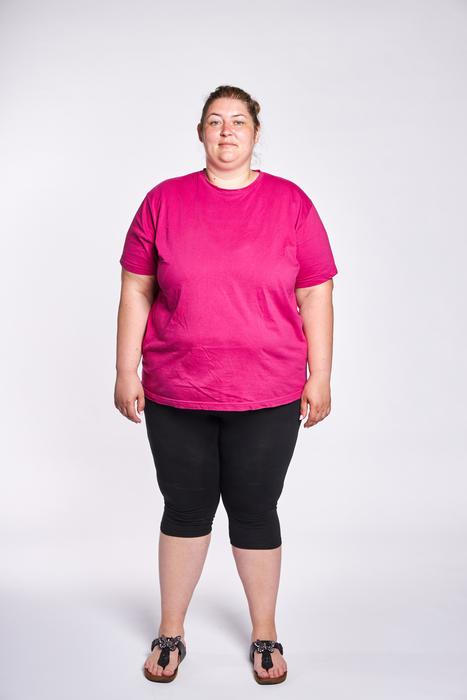 Extrémní proměny SK: Soňa