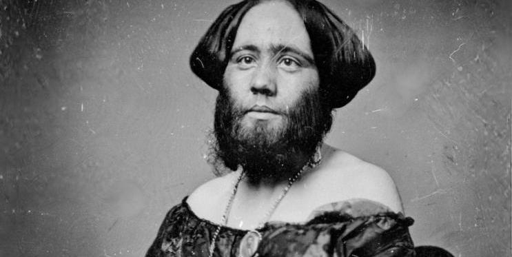  Josephine Clofullia (1829–1870) byla slavná vousatá dáma švýcarského původu, která se proslavila především tím, že byla součástí „Amerického muzea“ P. T. Barnuma