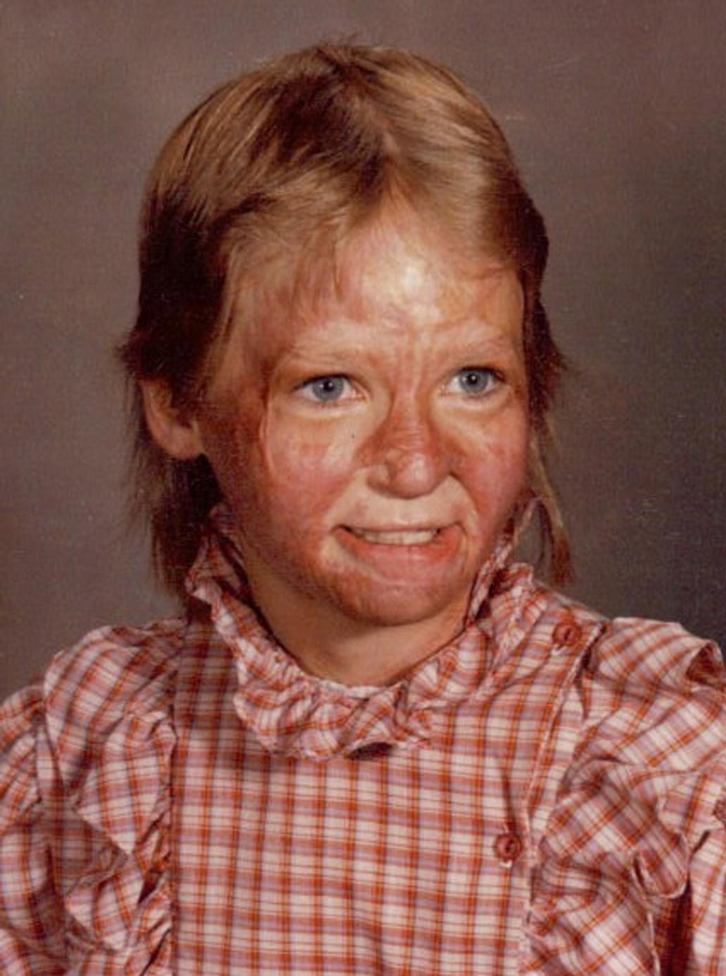 Danette Burzlaff-Haagová