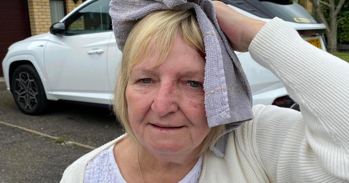 Sedmdesátiletá Lesley Wright klidně kráčela po ulici, náhle se z ničeho nic snesl ze vzduchu racek a prudce ji udeřil do hlavy.