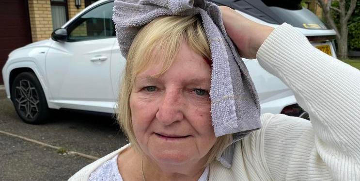 Sedmdesátiletá Lesley Wright klidně kráčela po ulici, náhle se z ničeho nic snesl ze vzduchu racek a prudce ji udeřil do hlavy.