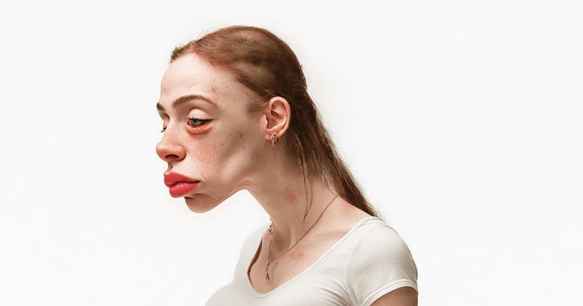 Podle výzkumu může lidem životní styl spjatý se sociálními sítěmi ovlivnit jejich zdraví a vzhled.