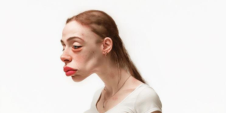 Podle výzkumu může lidem životní styl spjatý se sociálními sítěmi ovlivnit jejich zdraví a vzhled.