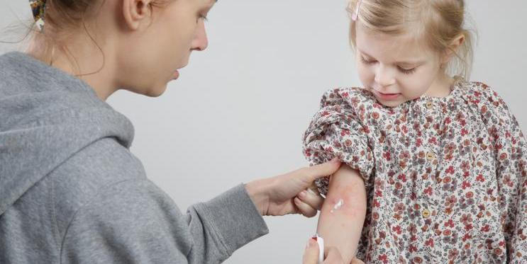 Maminka a dítě s atopickým ekzémem