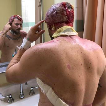 John Pendleton přežil zásah, který by zabil většinu lidí