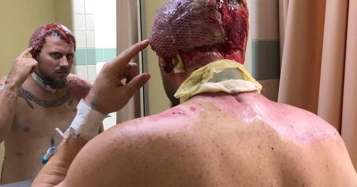 John Pendleton přežil zásah, který by zabil většinu lidí