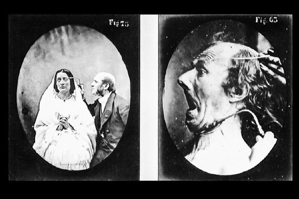 https://en.wikipedia.org/wiki/The_Expression_of_the_Emotions_in_Man_and_Animals
 Experiments in physiology. Facial expressions
Description 	

16 images showing different facial expressions which are being induced by electrical currents 