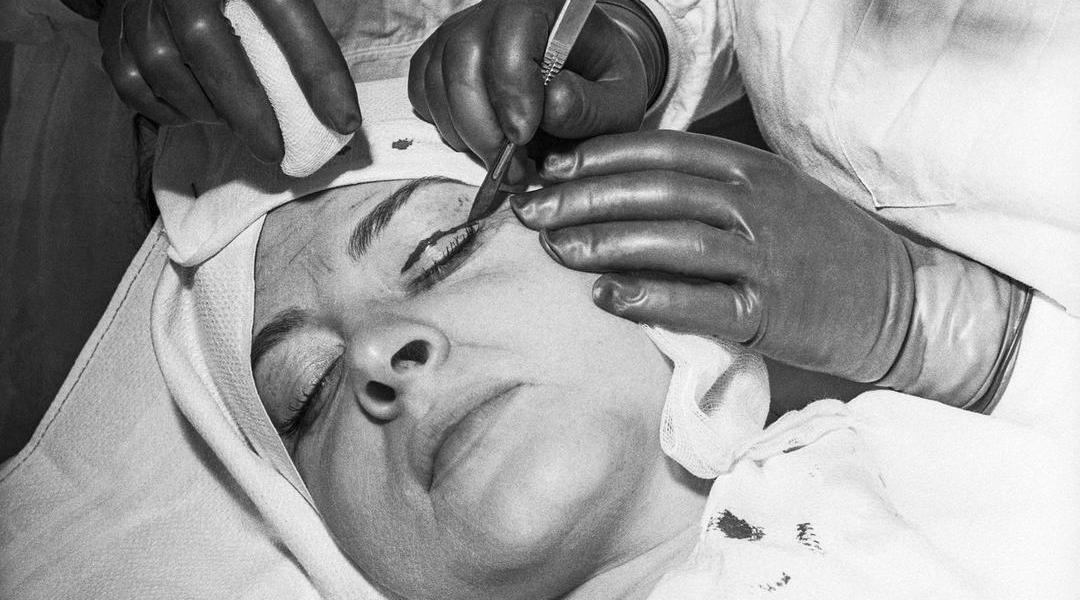 Plastická chirurgie