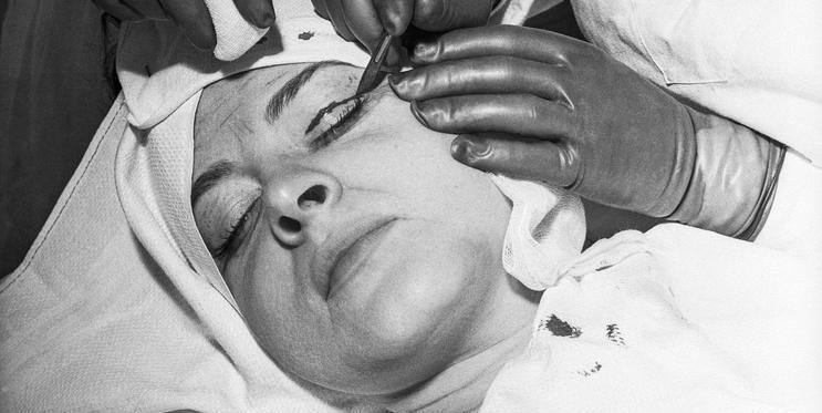 Plastická chirurgie