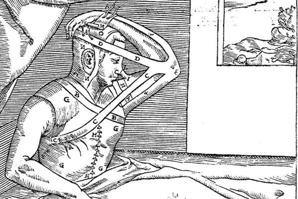 English: Gaspare Tagliacozzi - De curtorum chirurgia per insitionem - Illustration n. 8
Italiano: Gaspare Tagliacozzi - De curtorum chirurgia per insitionem - Illustrazione n. 8
Date 1597
Source https://books.google.it/books?id=5qg1lwTm79cC&printsec=titlepage&source=gbs_summary_r&cad=0
Author Gaspare Tagliacozzi - scanned by Google