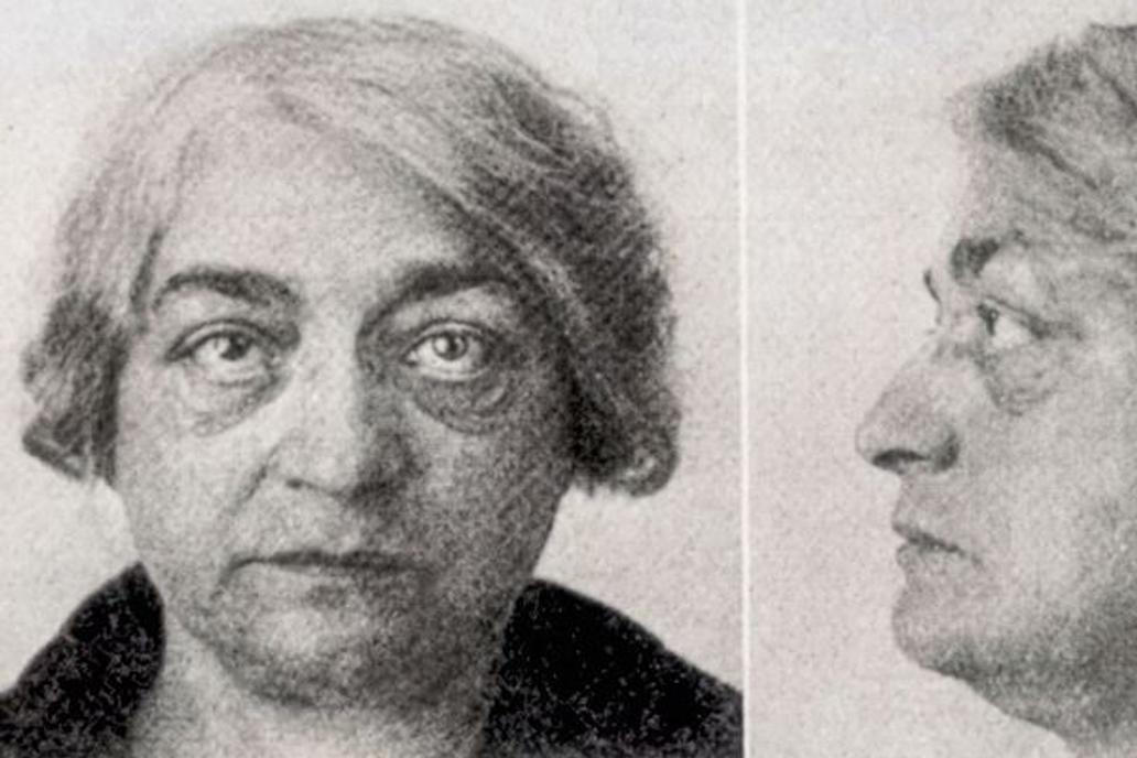 1878
Example of one of the first facelifts performed by a woman, the French surgeon Suzanne Noel (1878-1954). Noel began her medical studies in 1905 in dermatology but soon moved into the field of cosmetic surgery. She worked as a reconstructive surgeon during World War I. This image shows a woman before her facelift (top) and after (bottom).,Image: 245696523, License: Rights-managed, Restrictions: , Model Release: no, Credit line: Profimedia