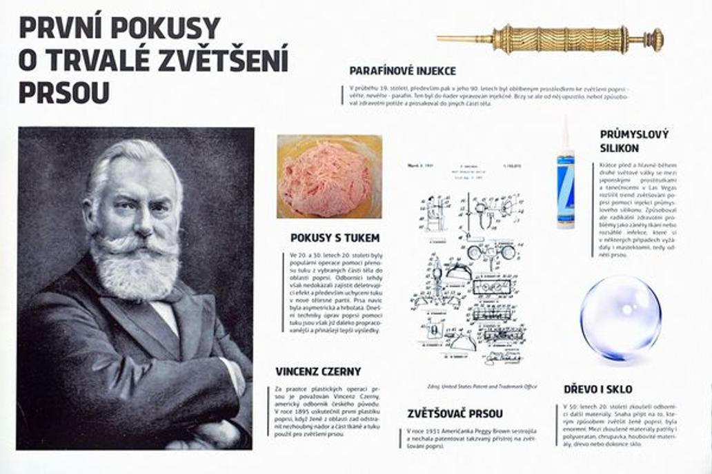 2015,Tisková konference u příležitosti otevření výstavy "Od korzetu k silikonům aneb Historie tvarování a plastických operací poprsí" k 50. výročí prvních plastických operací prsou, se uskutečnila 11. května v Hotelu Palace.,Image: 670560275, License: Rights-managed, Restrictions: , Model Release: no, Credit line: ČTK / Šimková Veronika