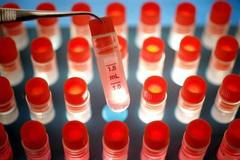 Vzorek kmenových buněk