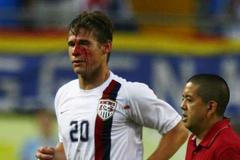 USA - Itálie: Brian McBride