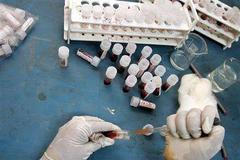 Testování HIV v Indii