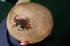 Zraněný fanoušek Manchesteru United