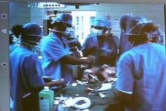 Operace siamských dvojčat