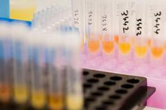 Doping, testy, ampule s močí, vzorky moči, Lausanne