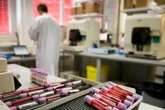 Doping, krevní testy, ampule s krví, Lausanne, laboratoř