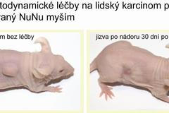 Fotodynamická léčba