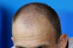 Euro 2008 : David Jarolím