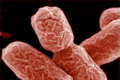 Střevní bakterie Enterohemorhagická Eshcherichia Coli (EHEC)