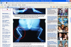 Bruliie - první žába s protézou na světě