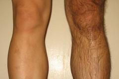 Nohy - holit či neholit?