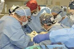 Transplantace tváře USA