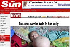 Roční dívenka čeká dítě