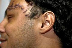 Felipe Massa po propuštění z nemocnice v Buadpešti