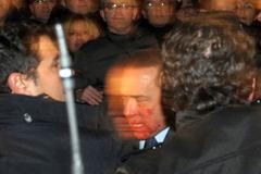 Zraněný Silvio Berlusconi