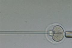 Umělé oplodnění - ilustrační foto