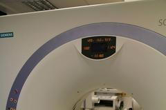 Radiologové prozkoumali skelet Tychona Brahe