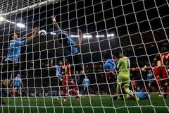 Uruguay: Suarez ruka