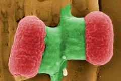 Střevní bakterie Enterohemorhagická Eshcherichia Coli (EHEC)