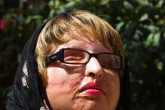 Íránka Amáni Bahramíová, oslepená kyselinou, útočníkovi odpustila