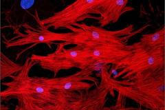 Buňky srdečního svalstva