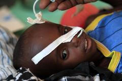 Hladomor v Somálsku