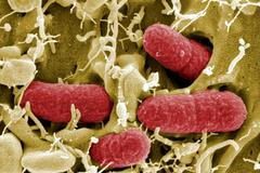 Střevní bakterie Enterohemorhagická Eshcherichia Coli (EHEC)
