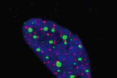 Jádro buňky sarkomové buněčné linie